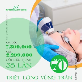 Triệt lông vùng trán